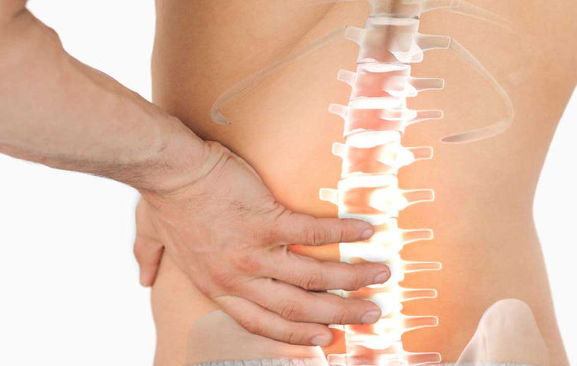 How to Ease Sciatica at Home
